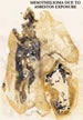 Mestothelioma due to asbestos