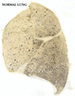 Normal Lung